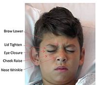 Child making facial expressions associated with pain