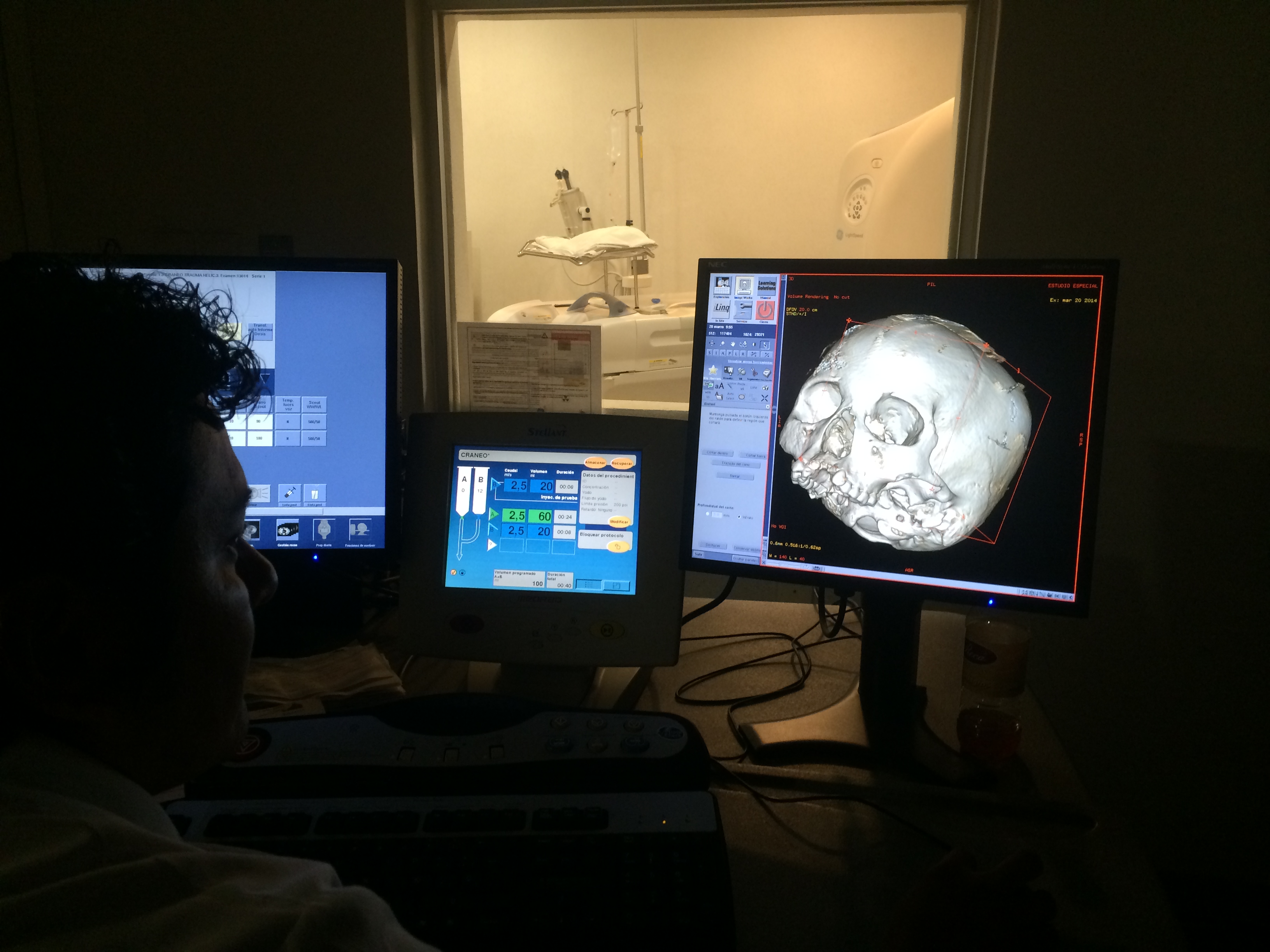 Specialists in Campeche perform a CT scan of Naia's cranium. Photo by James C. Chatters.