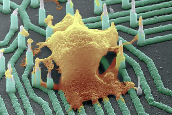 Neuron (orange) interfacing with nanowire array